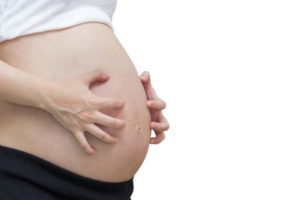 妊娠線がかゆい！かゆみの原因・予防・対策を徹底解説